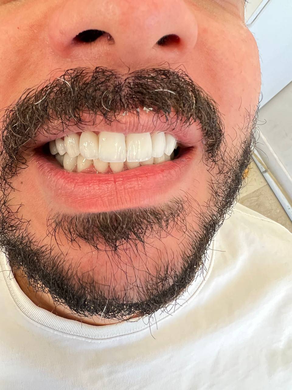 بعد از درمان